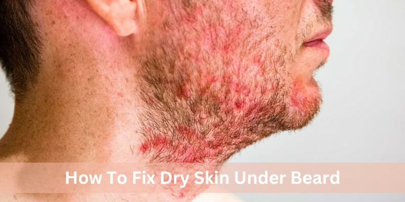 How To Fix Dry Skin Under Beard