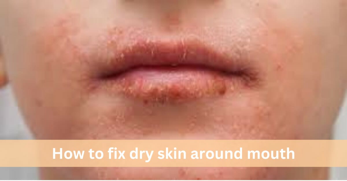 How to fix dry skin around mouth