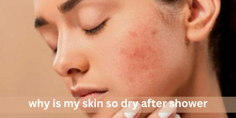 why is my skin so dry after shower | Complete Guide