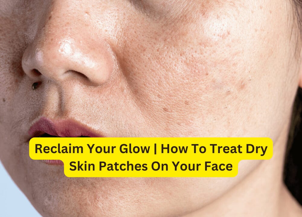 Reclaim Your Glow | How To Treat Dry Skin Patches On Your Face