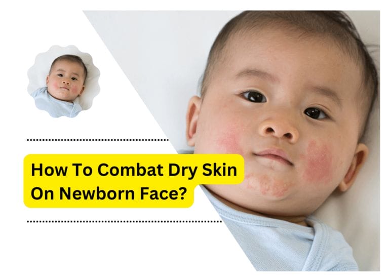 How to Combat Dry Skin on newborn Face?