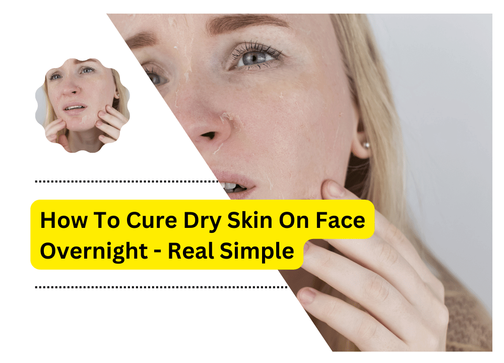 how-to-cure-dry-skin-on-face-overnight-real-simple