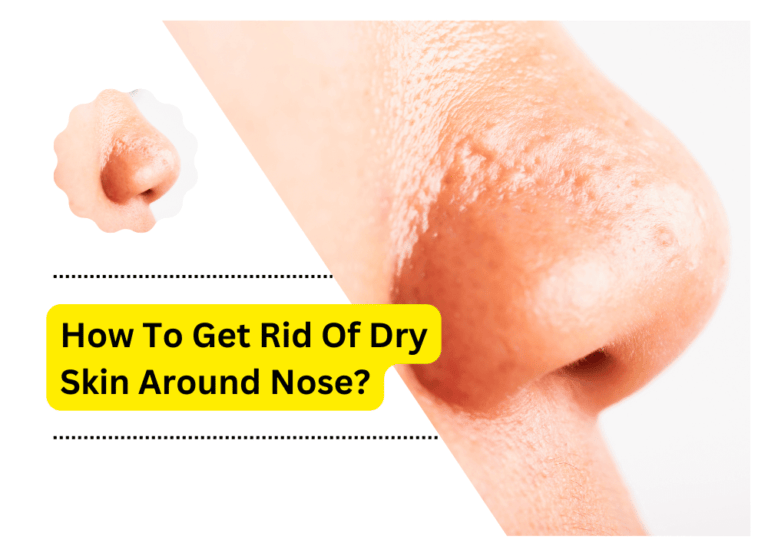 How To Get Rid Of Dry Skin Around Nose?
