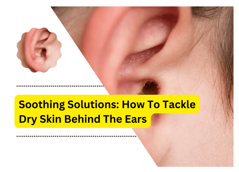 Dry Skin Behind The Ears