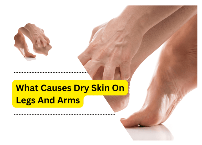 What Causes Dry Skin On Legs And Arms