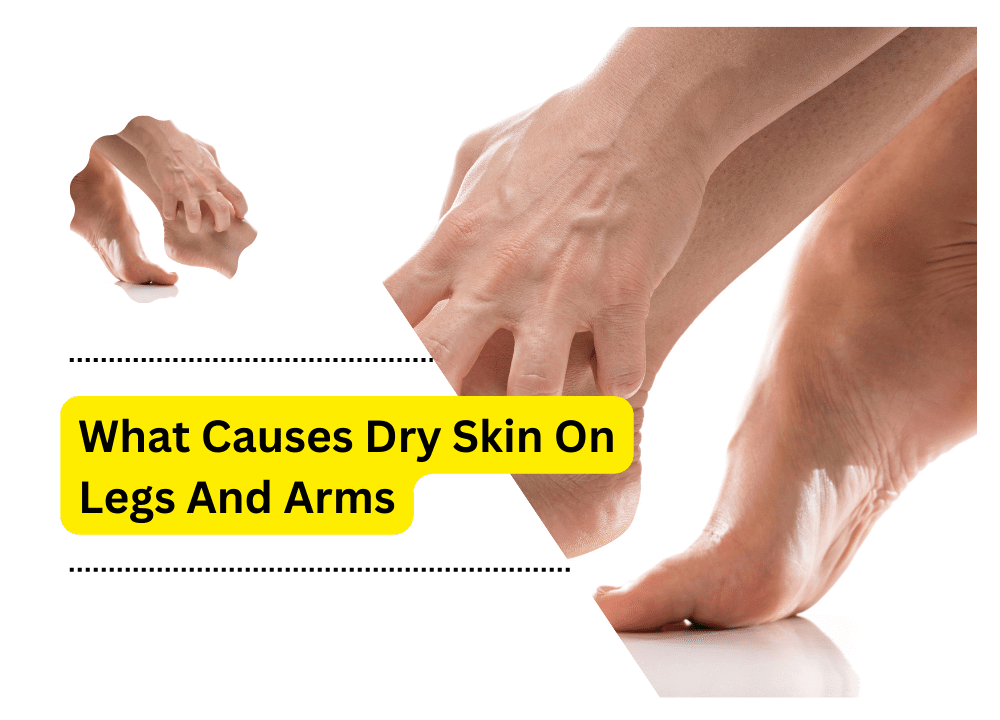 What Causes Dry Skin On Legs