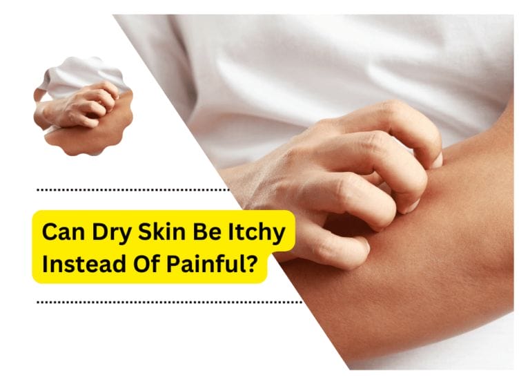 Can Dry Skin Be Itchy Instead Of Painful?