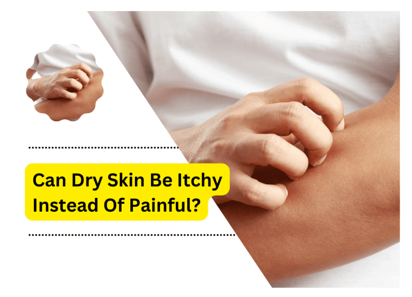 Can Dry Skin Be Itchy