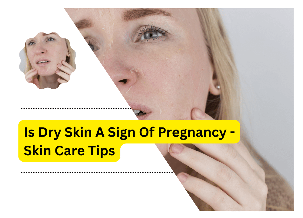 Is Dry Skin A Sign Of Pregnancy