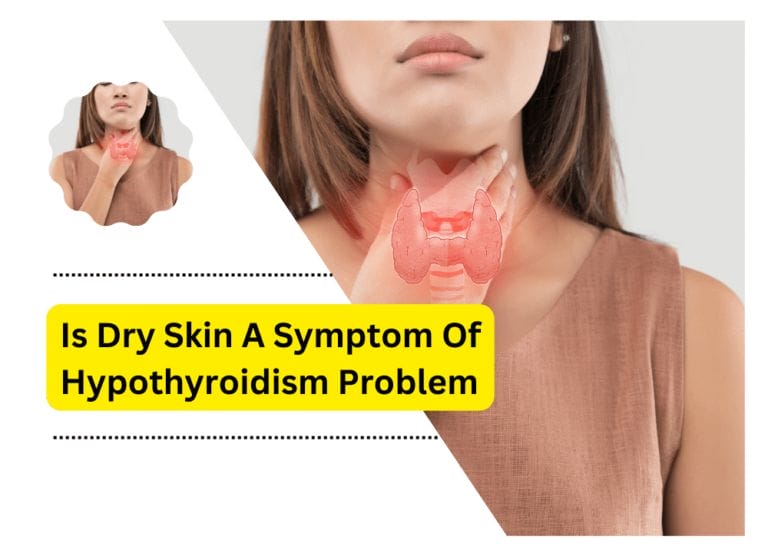 Is Dry Skin A Symptom Of Hypothyroidism Problem