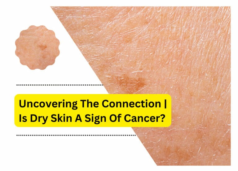 Uncovering The Connection | Is Dry Skin A Sign Of Cancer?