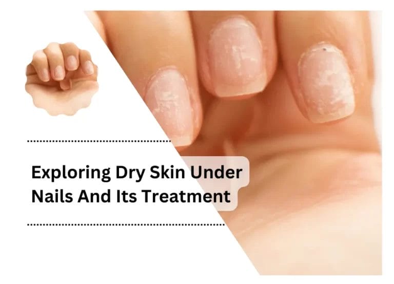 Exploring Dry Skin Under Nails And Its Treatment