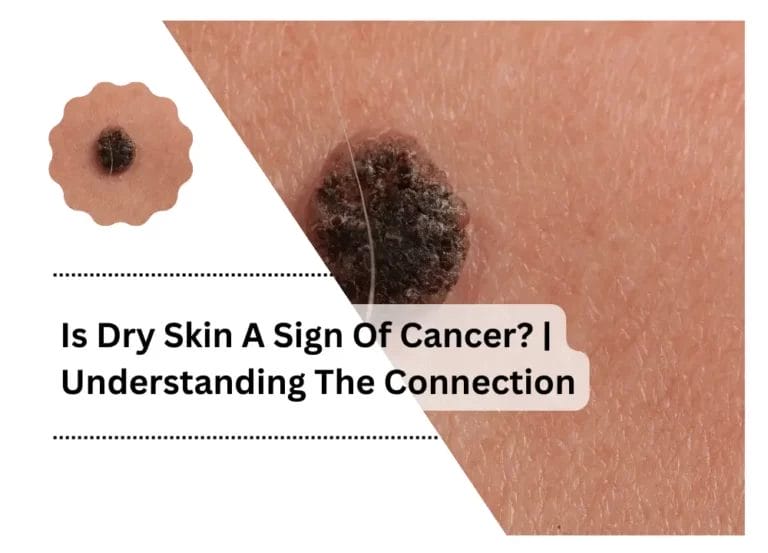 Is Dry Skin A Sign Of Cancer? | Understanding The Connection