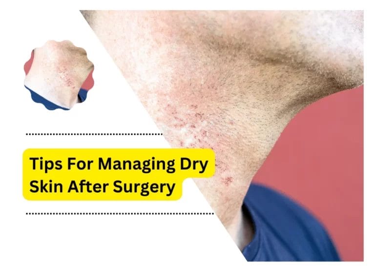 Tips For Managing Dry Skin After Surgery