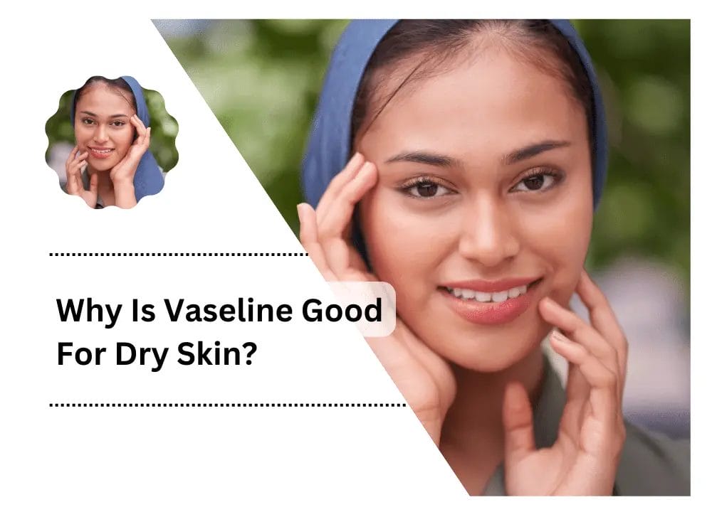 Is Vaseline Good For Dry Skin