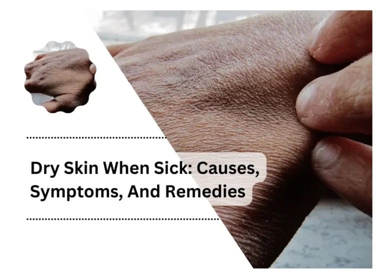 Dry Skin When Sick: Causes, Symptoms, And Remedies