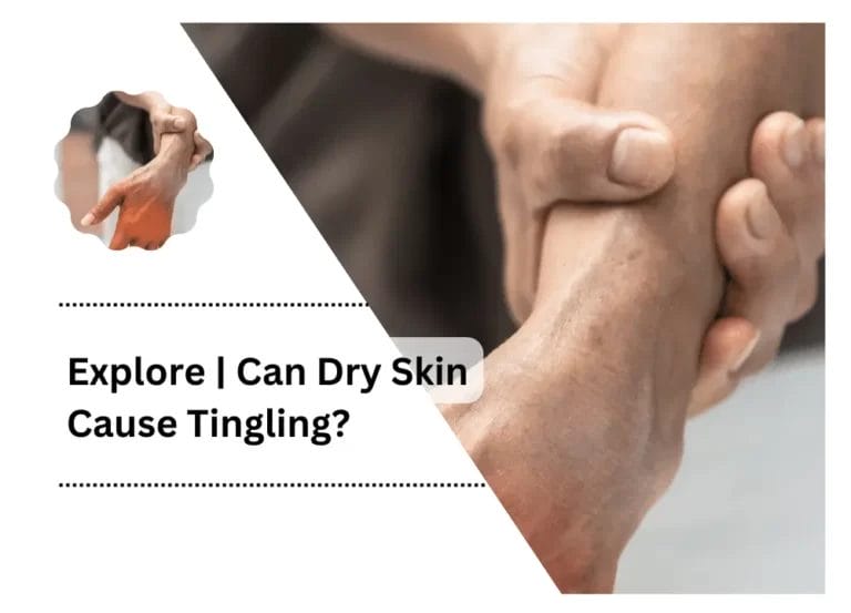Explore | Can Dry Skin Cause Tingling?