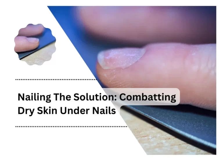 Nailing The Solution: Combatting Dry Skin Under Nails