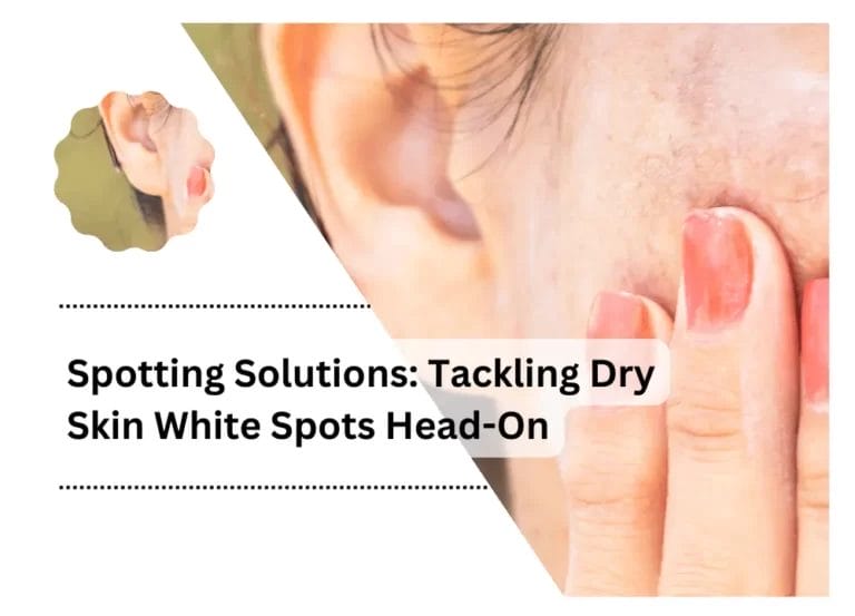 Spotting Solutions: Tackling Dry Skin White Spots Head-On
