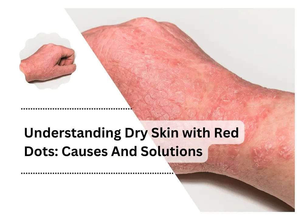 Dry Skin with Red Dots