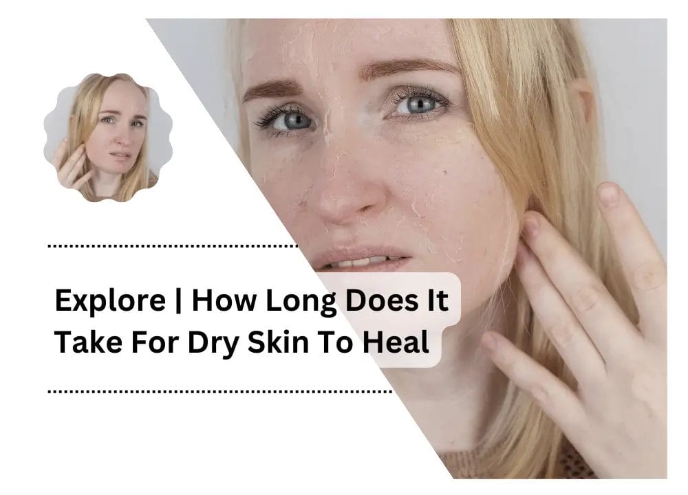 How Long Does It Take For Dry Skin To Heal