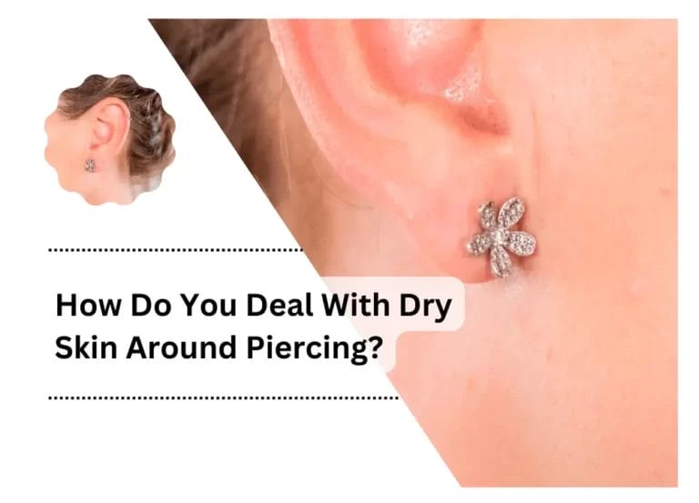 How Do You Deal With Dry Skin Around Piercing?