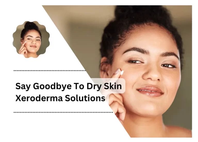 Say Goodbye To Dry Skin Xeroderma Solutions