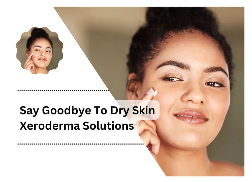 Dry Skin Xeroderma