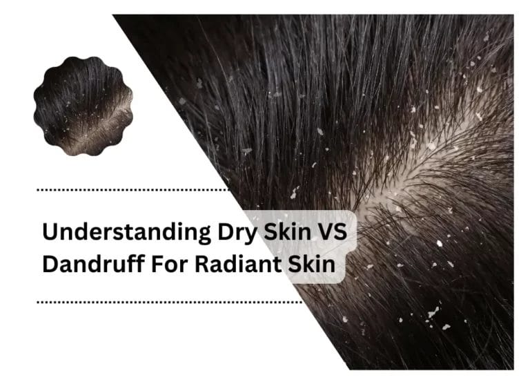 Understanding Dry Skin VS Dandruff For Radiant Skin