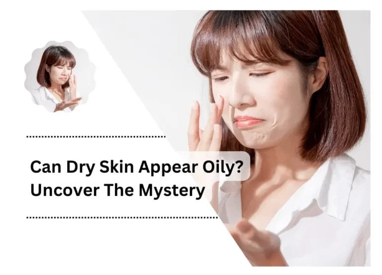 Can Dry Skin Appear Oily? Uncover The Mystery