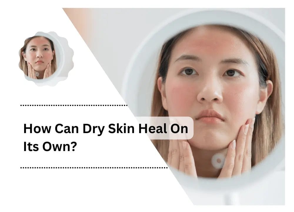 Can Dry Skin Heal On Its Own