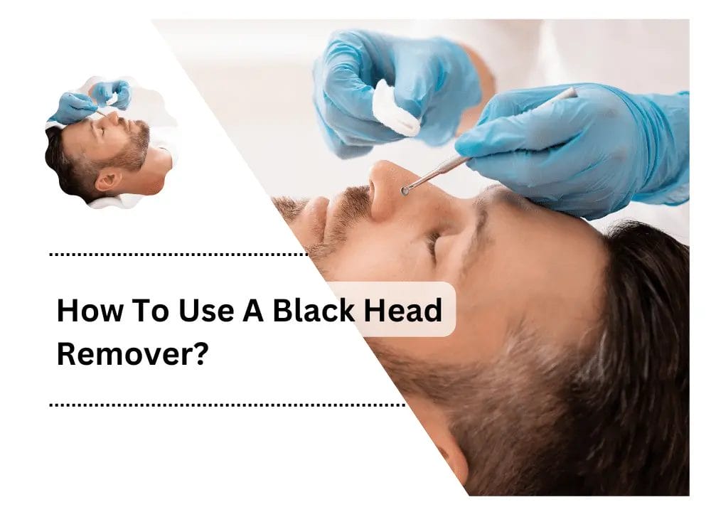 Black Head Remover