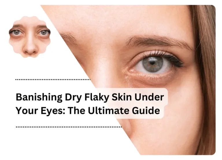 Banishing Dry Flaky Skin Under Your Eyes: The Ultimate Guide