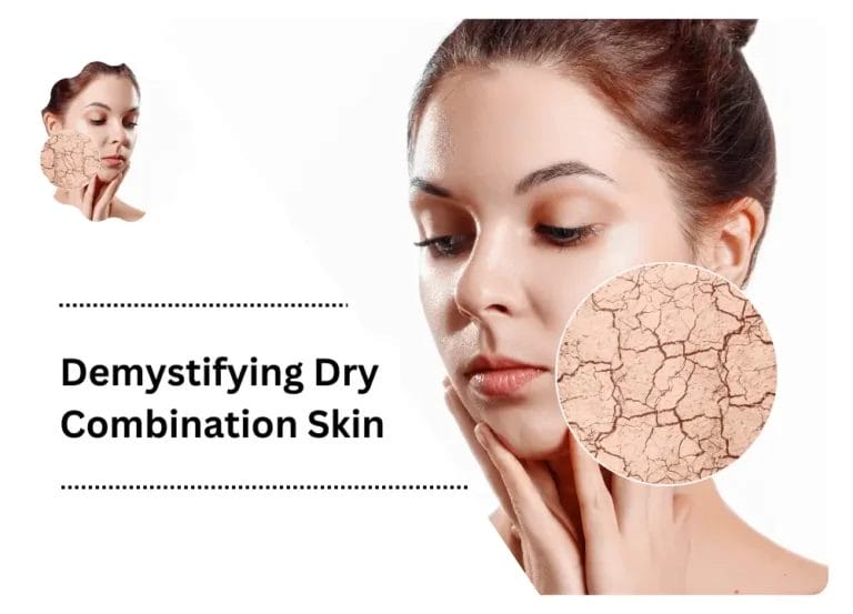 Demystifying Dry Combination Skin