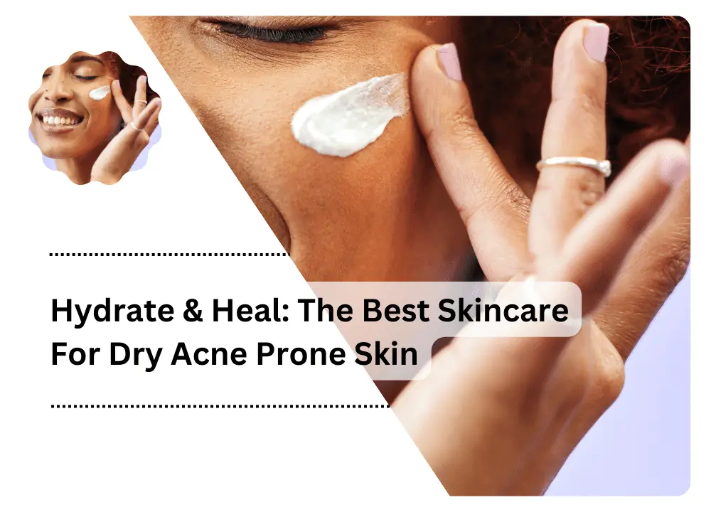 Skincare For Dry Acne Prone Skin
