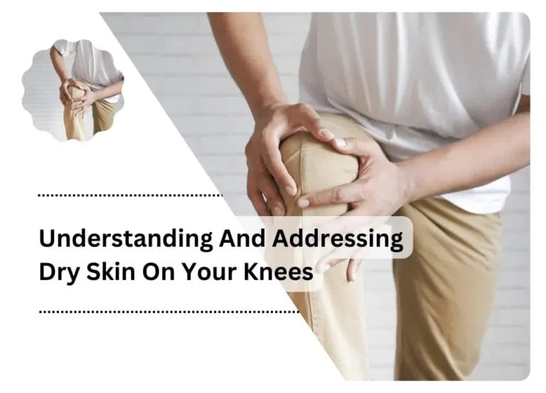 Understanding And Addressing Dry Skin On Your Knees